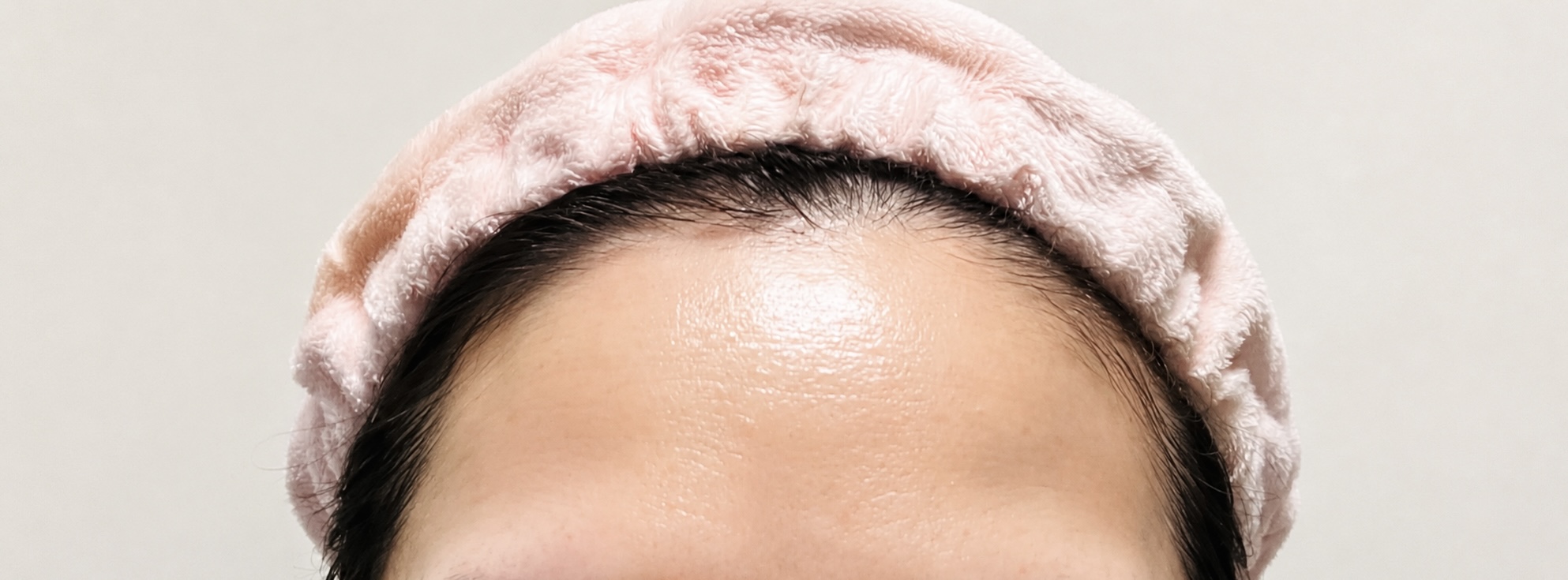ANLAN使用前のおでこの状態、ピンクのヘアバンド着用